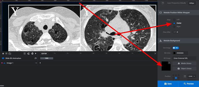 Slider-Revolution-‹-The-Yale-Center-For-Interactive-Digital-Education-in-Radiology-—-WordPress